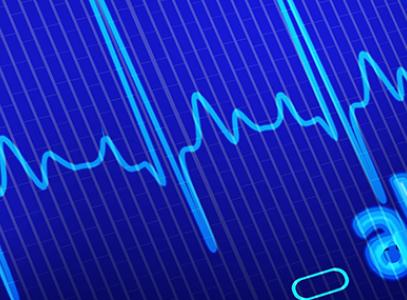 Аритмия: виды, диагностика и лечение